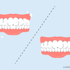 what happens if you don't floss