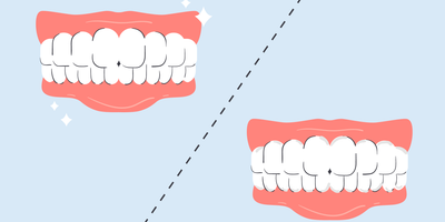 what happens if you don't floss