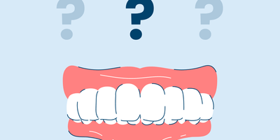 What is a deep overbite?