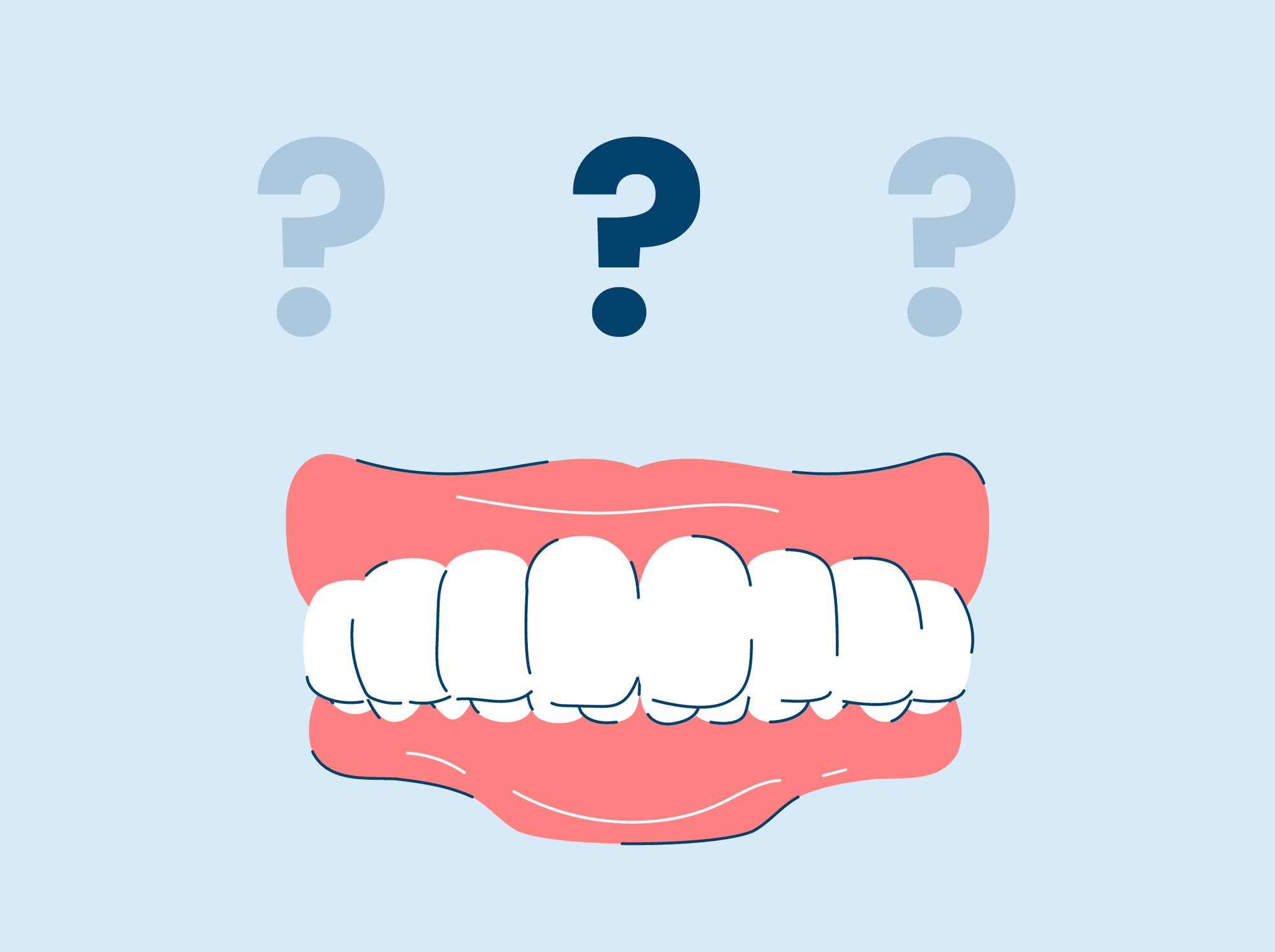 What is a deep overbite?