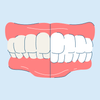 What Is An Overbite and How Can Overbite Teeth Be Fixed?