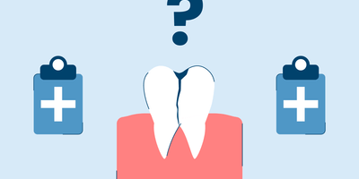 cracked molar