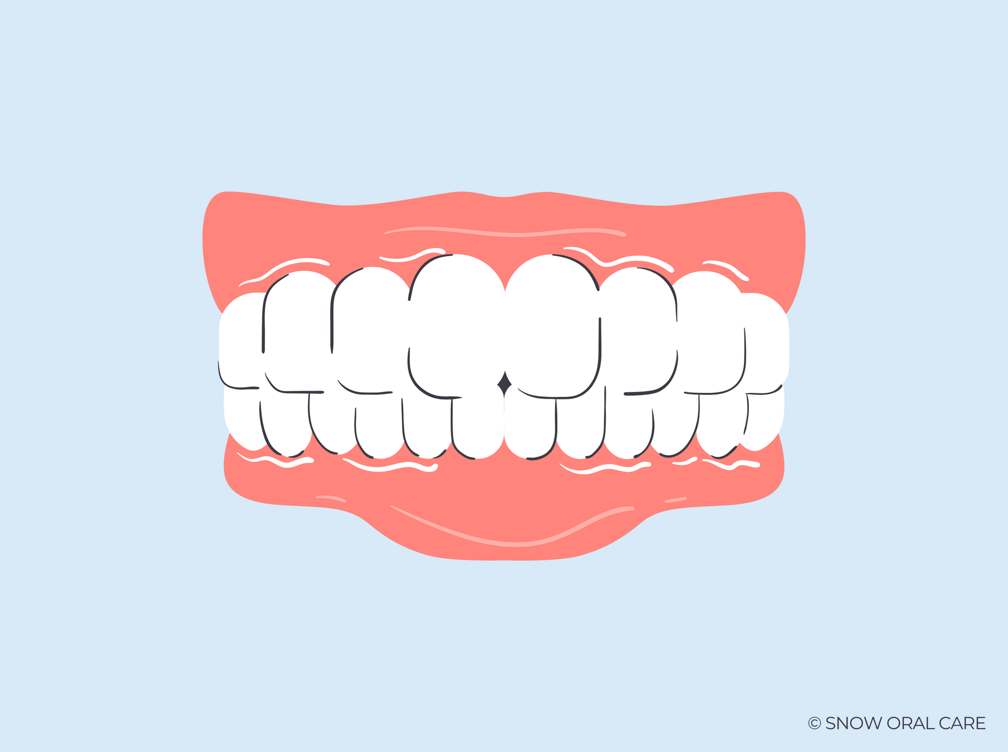 white line on gums below teeth 