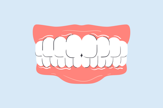white line on gums below teeth 