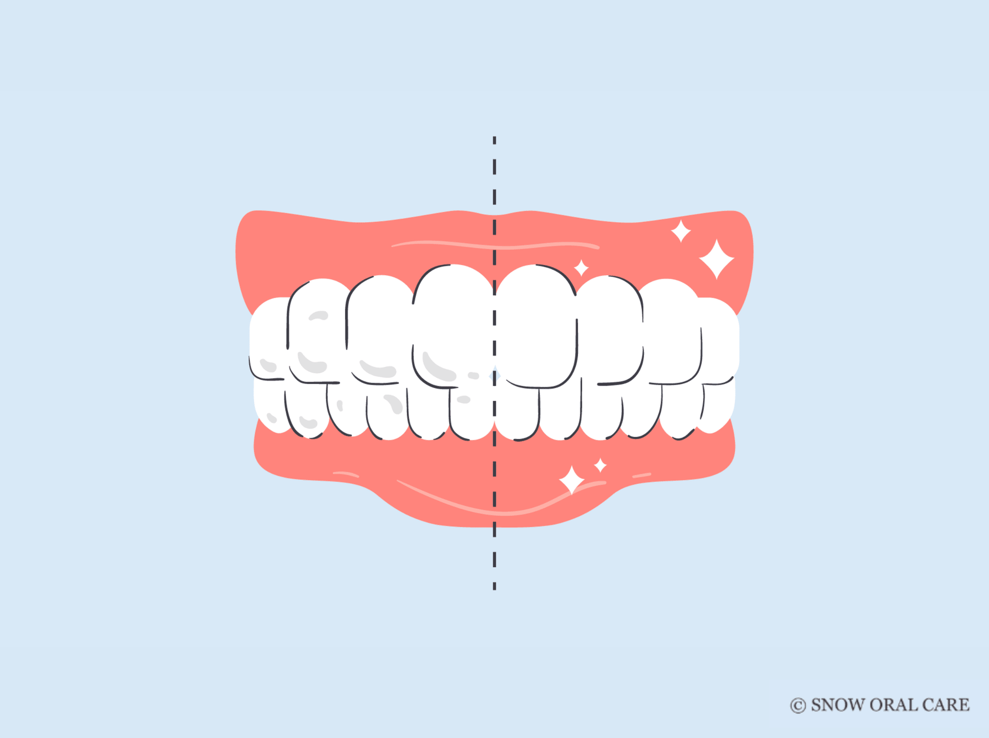 white specks on teeth