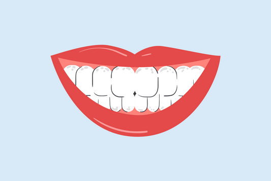 white spots on teeth near gums 
