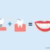 whitening fake and real teeth together 