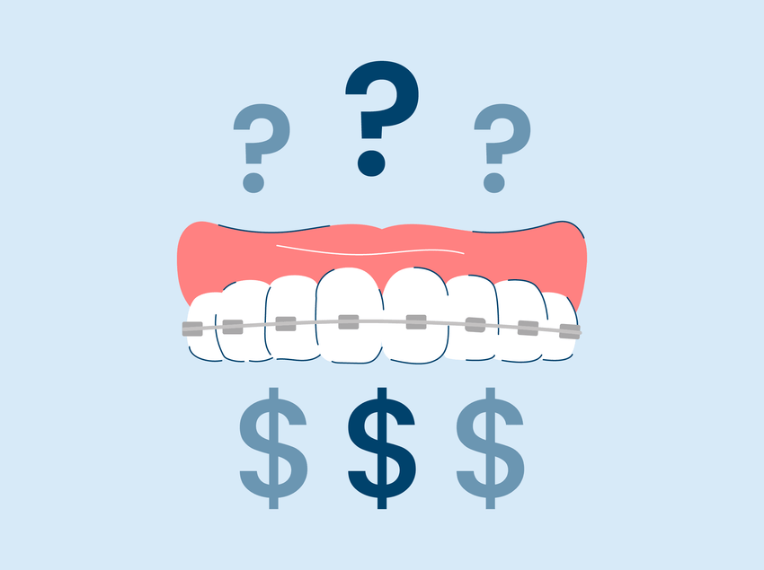 why are braces so expensive