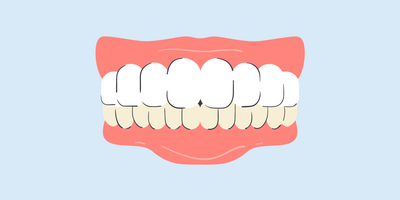 why are my bottom teeth more yellow 