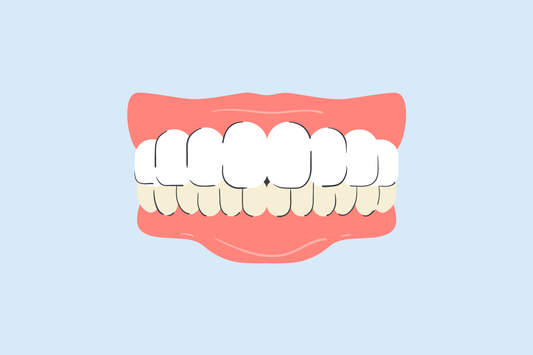 why are my bottom teeth more yellow 