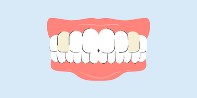 why are my canine teeth yellow 