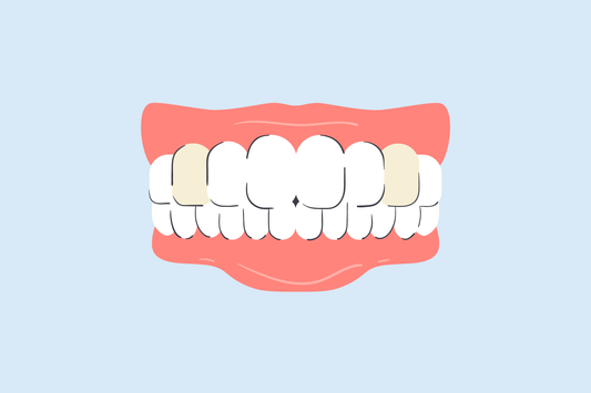 why are my canine teeth yellow 
