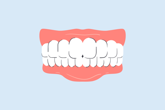 why are teeth white 
