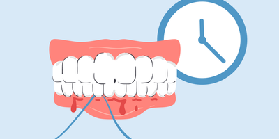 why do gums bleed after not flossing for a while