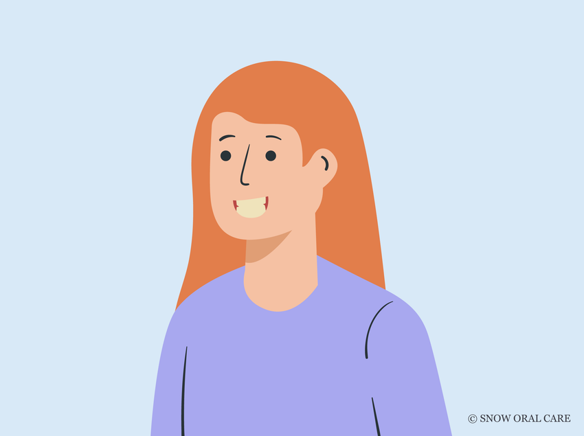 why do redheads have yellow teeth 