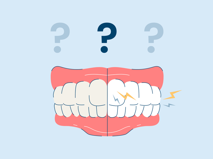 Why Do Whitening Strips Hurt My Teeth?
