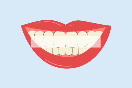 why don't whitening strips cover all teeth 