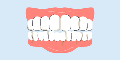 why is my spit brown when i brush my teeth 