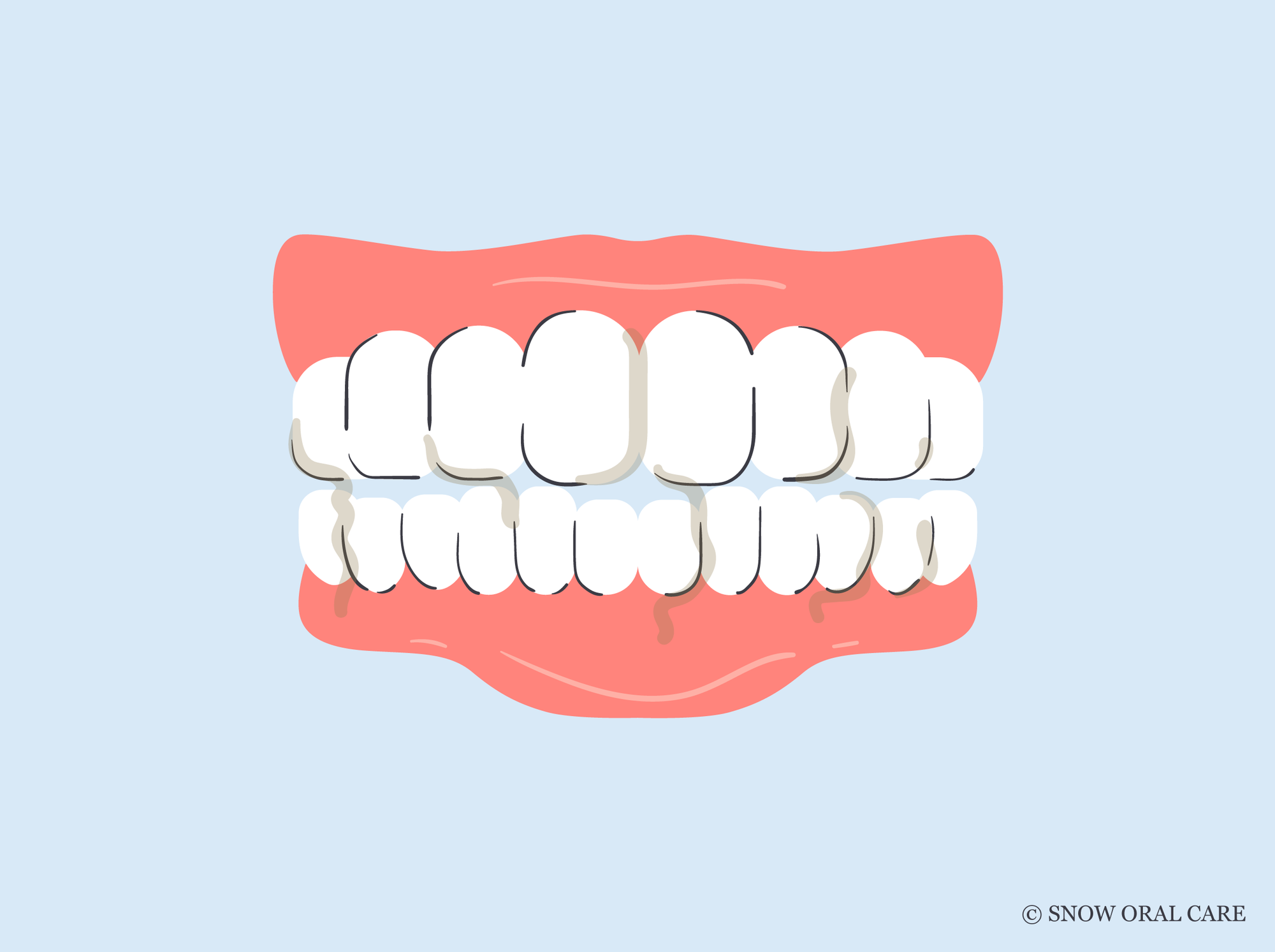 why is my spit brown when i brush my teeth 