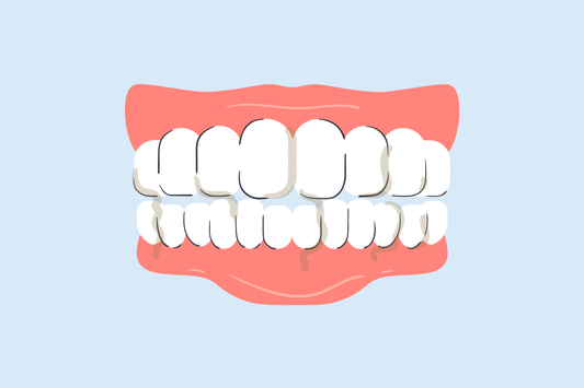 why is my spit brown when i brush my teeth 