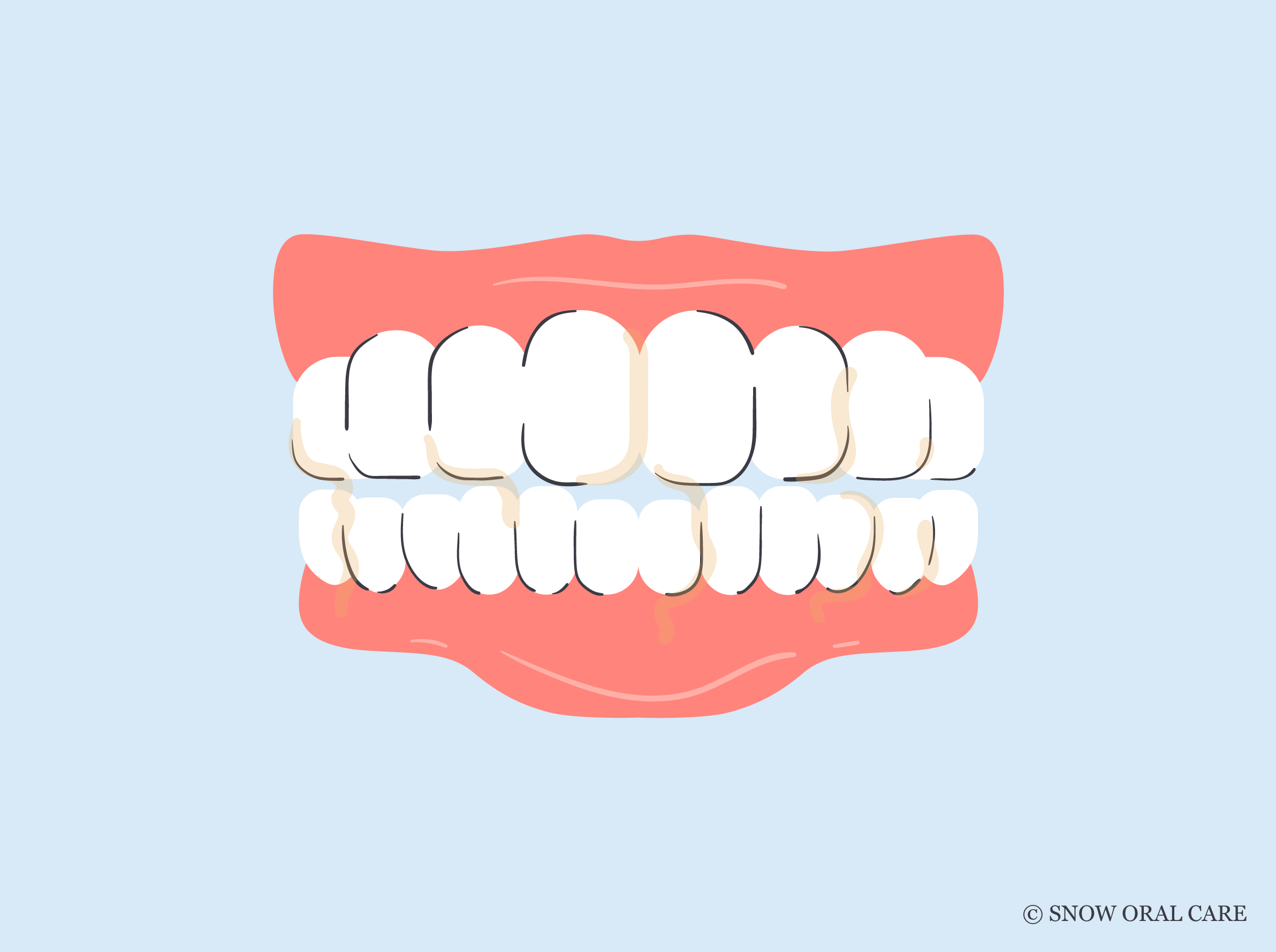 Spouting Teeth Why Is My Spit Yellow When I Brush My Teeth? Real Causes! – SNOW® Oral Care