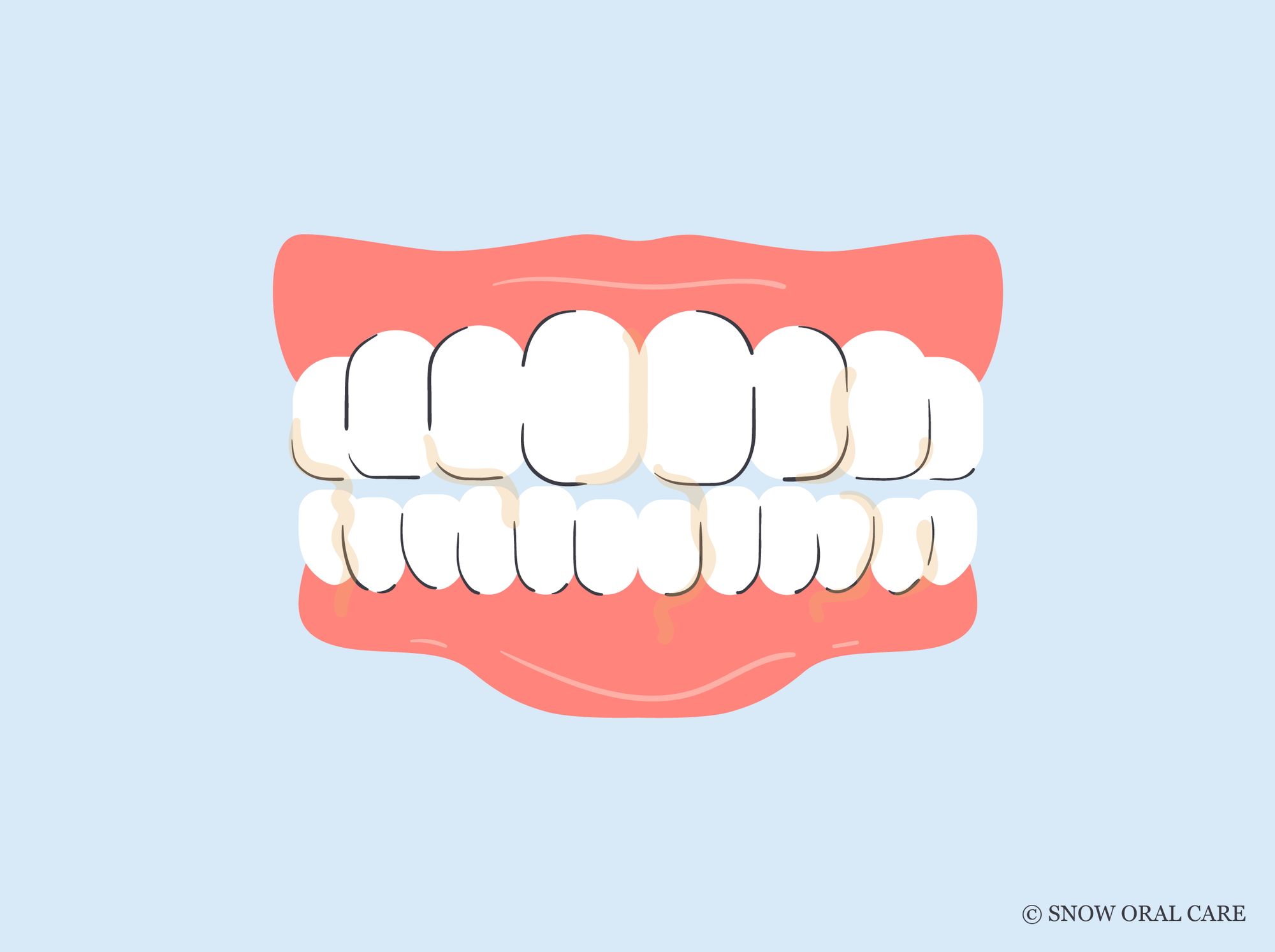 why is my spit yellow when i brush my teeth 