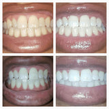 Brighten + Whiten Premium Bundle