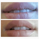 Overnight Lip Treatment