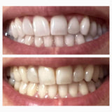 BOGO Teeth Whitening Wipes | Teeth Whitening Wipes | SNOW® Oral Care