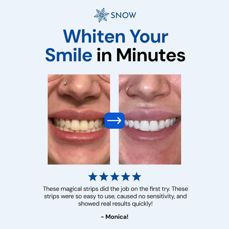DiamondSeries® Patented Dissolving Teeth Whitening Strips with Hydroxyapatite