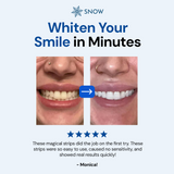 Theeth Whitening Diamond Strips |Teeth Diamond Strip | SNOW® Oral Care