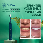 LED Whitening Electric Toothbrush (Gen 2) - Limited Offer - SNOW® Oral Care