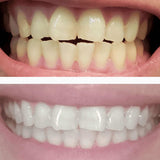 DiamondSeries Wands 1.7mL, 1pk (DTC) - SNOW® Oral Care