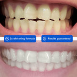 Diamond Wireless Teeth Whitening Kit - SNOW® Oral Care