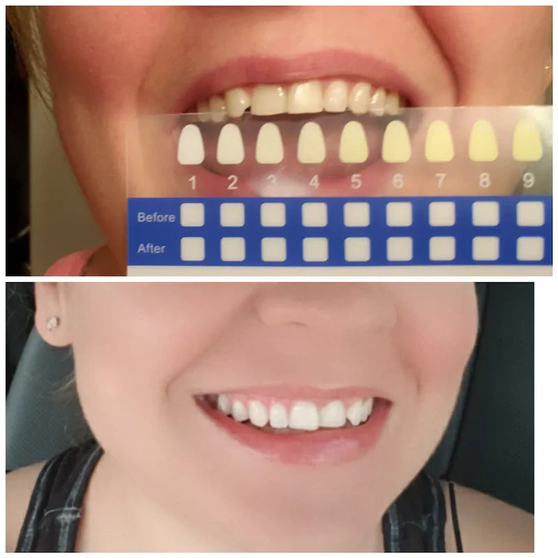 Before/After
