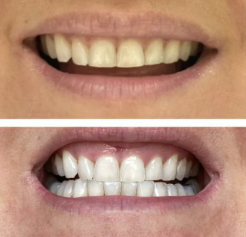 Before/After