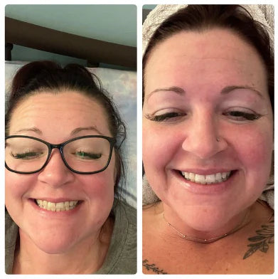 Real user before and after smile results from using Snow Whitening Pen