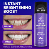 Instant Teeth Brightening Purple Serum - SNOW® Oral Care