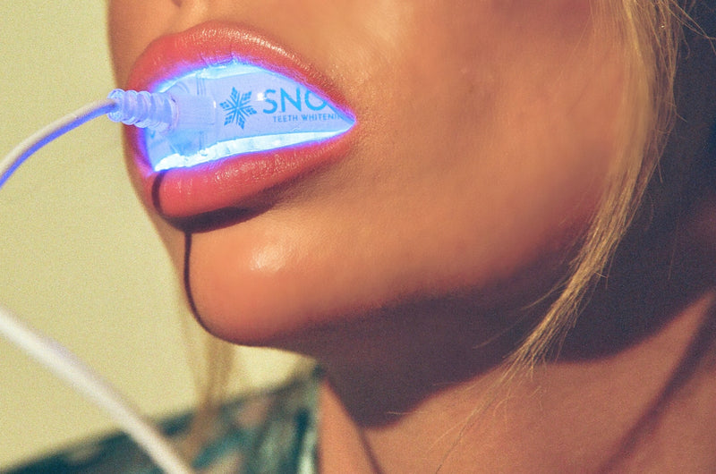 SNOW® Diamond Series Teeth Whitening Kit | Professional Whitening at Home (3 Serums)