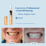 teeth-whitening-pen