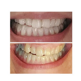 Magic Whitening Toothpaste Booster® Powder with Hydroxyapatite - World's First & Only! Sprinkle or Dip!