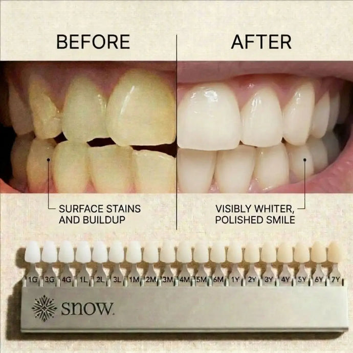 SNOW® Magic Teeth Whitening Powder | Hydroxyapatite